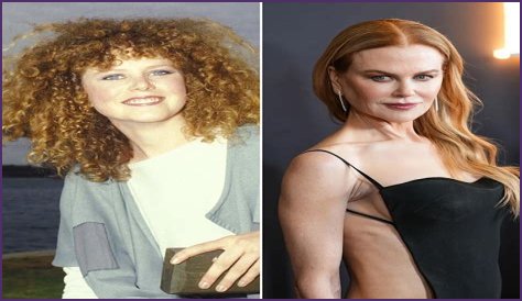 Nicole Kidman's 